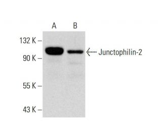 western blotting image from recommended Junctophilin-2 (H-3) monoclonal antibody replacement. Image 296010