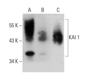 western blotting image from recommended KAI 1 (G-10) monoclonal antibody replacement. Image 384669