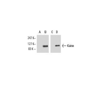 Kaiso Antibody (12H) - Western Blotting - Image 10679
