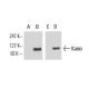 Kaiso Antibody (12H) - Western Blotting - Image 10679
