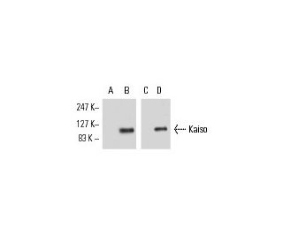 Kaiso Antibody (6F8) - Western Blotting - Image 8878 