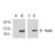 Kaiso Antibody (6F8) - Western Blotting - Image 8878 