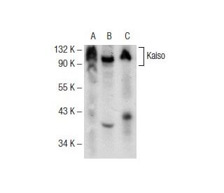 Kaiso Antibody (D-10) - Western Blotting - Image 141321 