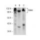 Kaiso Antibody (D-10) - Western Blotting - Image 141321 