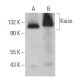 Kaiso Antibody (D-10) - Western Blotting - Image 359086