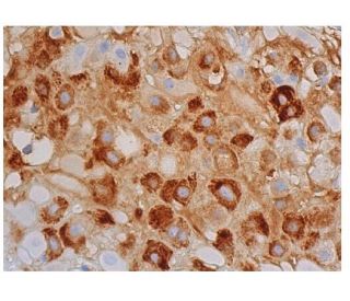 ABP1 Antibody (F-9) - Immunohistochemistry - Image 346415 
