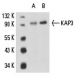 KAP3 Antibody (B-4) - Western Blotting - Image 15454 