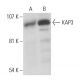 KAP3 Antibody (C-6) - Western Blotting - Image 15422