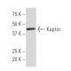 Kaptin Antibody (3B1) - Western Blotting - Image 34289 