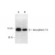 karyopherin 13 Antibody (A-9) - Western Blotting - Image 318057 