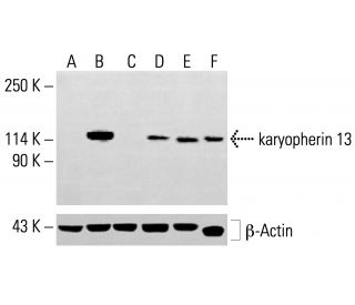 karyopherin 13 Antibody (D-3) - Western Blotting - Image 413909 