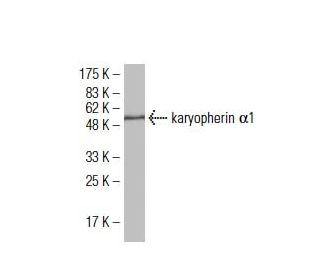karyopherin α1 Antibody (187.1) - Western Blotting - Image 34649