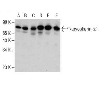 karyopherin α1 Antibody (187.1) - Western Blotting - Image 368203