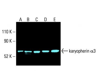 karyopherin &alpha;3 Antibody (B-1) - Western Blotting - Image 404710 