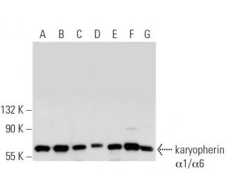 western blotting image from recommended karyopherin α1/6 (2D9) monoclonal antibody replacement. Image 19920