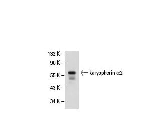 karyopherin &alpha;2 Antibody (1A6) - Western Blotting - Image 19918 
