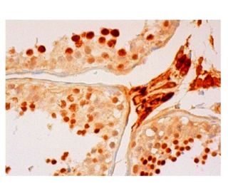 karyopherin &alpha;2 Antibody (8G5) - Immunohistochemistry - Image 315749 