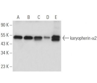 western blotting image from recommended karyopherin α2 (B-9) monoclonal antibody replacement. Image 14772