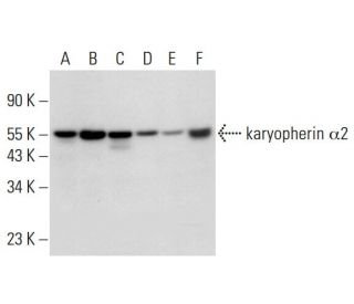 karyopherin &alpha;2 Antibody (G-7) - Western Blotting - Image 325171 