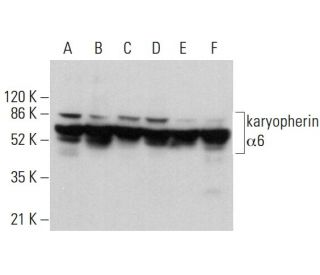 karyopherin &alpha;6 Antibody (E-11) - Western Blotting - Image 379908 