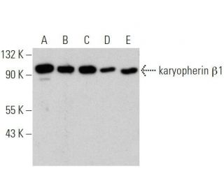 karyopherin β1 Antibody (E-7) - Western Blotting - Image 356162