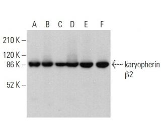 karyopherin &beta;2 Antibody (L5E3) - Western Blotting - Image 382253 