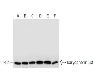 karyopherin β3 Antibody (A-2) - Western Blotting - Image 314051
