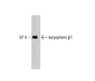 karyopherin &beta;1 Antibody (23) - Western Blotting - Image 127504