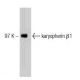 karyopherin β1 Antibody (23) - Western Blotting - Image 127504