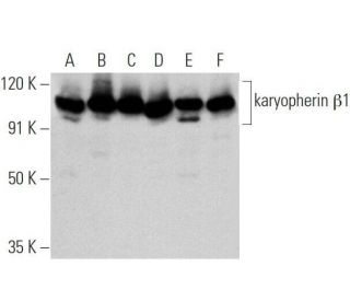 western blotting image from recommended karyopherin &beta;1 (H-7) monoclonal antibody replacement. Image 356163