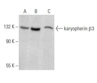karyopherin &beta;3 Antibody (E-4) - Western Blotting - Image 357336 