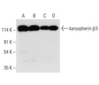 western blotting image from recommended karyopherin &beta;3 (B-7) monoclonal antibody replacement. Image 314052