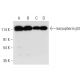 western blotting image from recommended karyopherin β3 (B-7) monoclonal antibody replacement. Image 314052