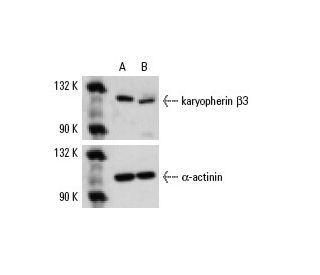 karyopherin &beta;3 siRNA (h): sc-35740. Western blot analysis of karyopherin &beta;3 expression in non-transfected contro 