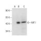 KAT I Antibody (C-7) - Western Blotting - Image 151196 