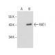 KAT I Antibody (H-5) - Western Blotting - Image 286087
