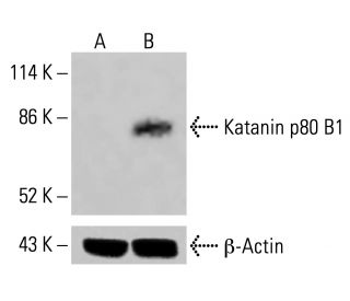 Katanin p80 B1 Antibody (C-4) - Western Blotting - Image 414927