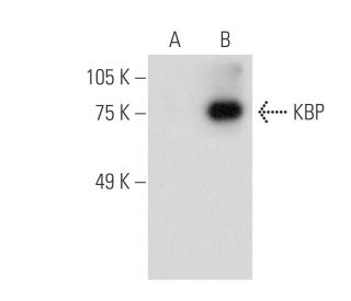 KBP Antibody (H-12) - Western Blotting - Image 288616