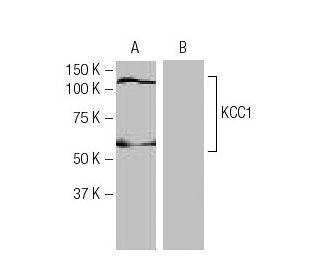 KCC1 Antibody (FT-94) - Western Blotting - Image 64980