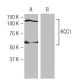KCC1 Antibody (FT-94) - Western Blotting - Image 64980