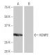 KChIP2 Antibody (9K9) - Western Blotting - Image 64982