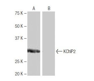 KChIP2 Antibody (9K9) - Western Blotting - Image 64982SAM Transcription Activation: SAM system utilizing dCas9-VP64, MS2-P65-HSF1, and sgRNA for precise gene transcription activation.