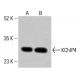 KChIP4 Antibody (H-1) - Western Blotting - Image 414449 