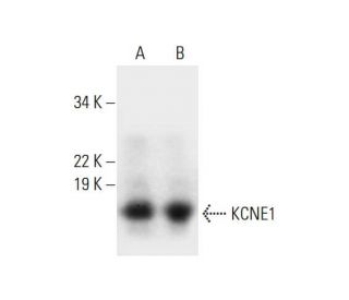 western blotting image from recommended KCNE1 (G-10) monoclonal antibody replacement. Image 297633