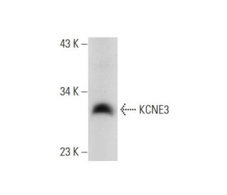 western blotting image from recommended KCNE3 (G-6) monoclonal antibody replacement. Image 299137