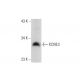 western blotting image from recommended KCNE3 (G-6) monoclonal antibody replacement. Image 299137