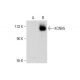 KCNH5 Antibody (A-6) - Western Blotting - Image 298010