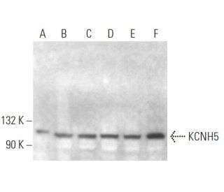 KCNH5 Antibody (A-8) - Western Blotting - Image 373277 