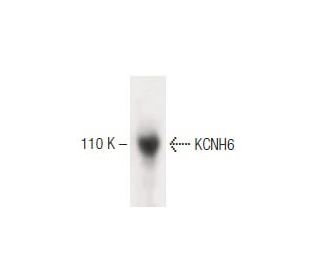 KCNH6 Antibody (46) - Western Blotting - Image 60337