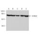 This polyclonal antibody has been discontinued. See our recommended <a href="kcnq1-antibody-g-8">KCNQ1 (G-8)</a> monoclonal antibody (sample data shown). western blotting image from recommended KCNQ1 (G-8) monoclonal antibody replacement. Image 359655